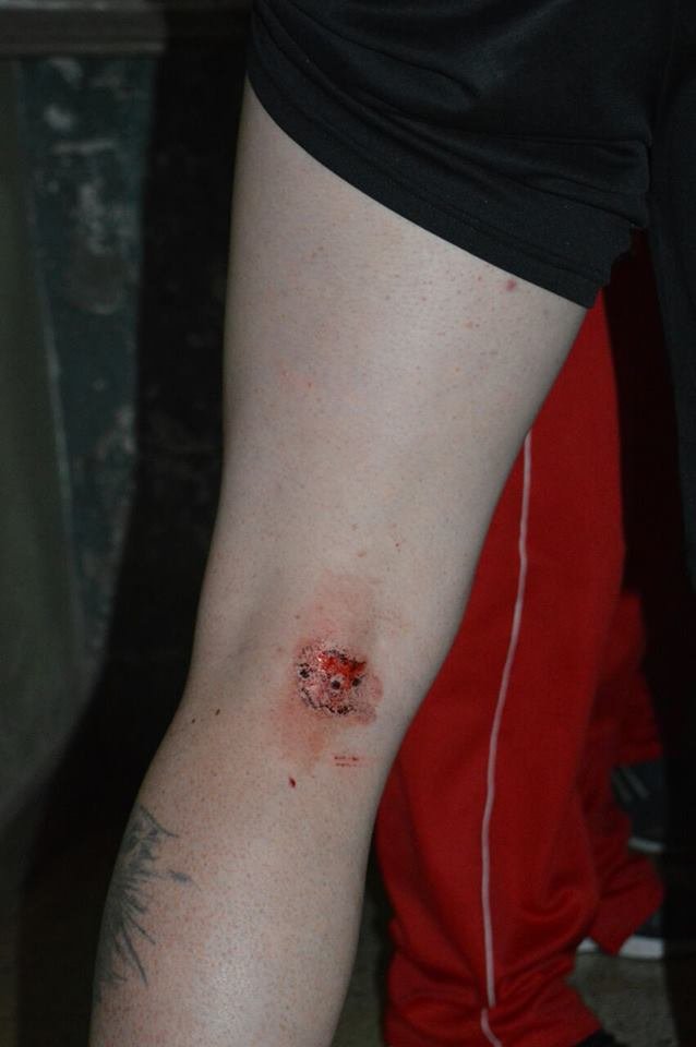 Agresion Sansinena 3