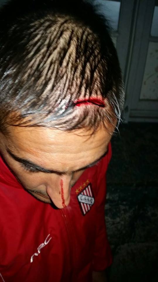 Agresion Sansinena 5