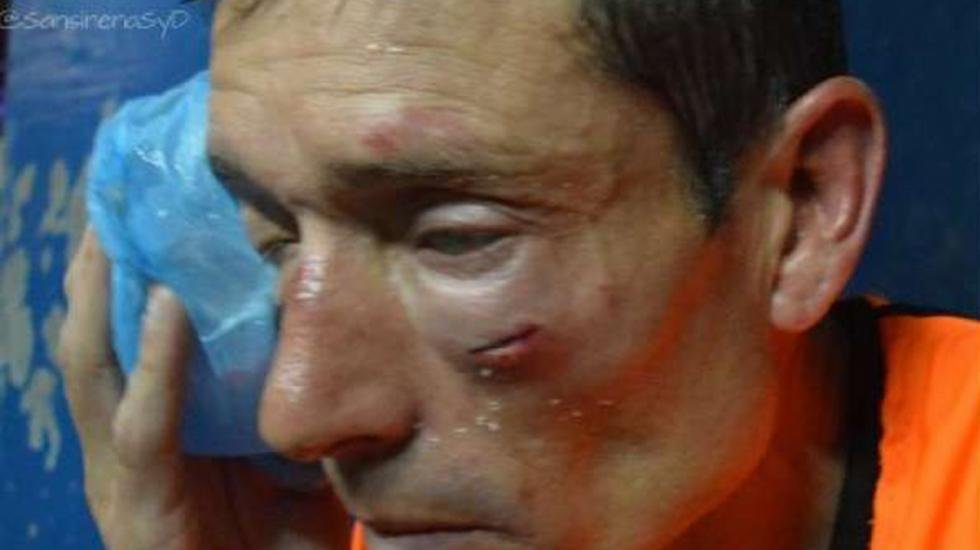 Elichiri: «No puedo ni levantar los labios»