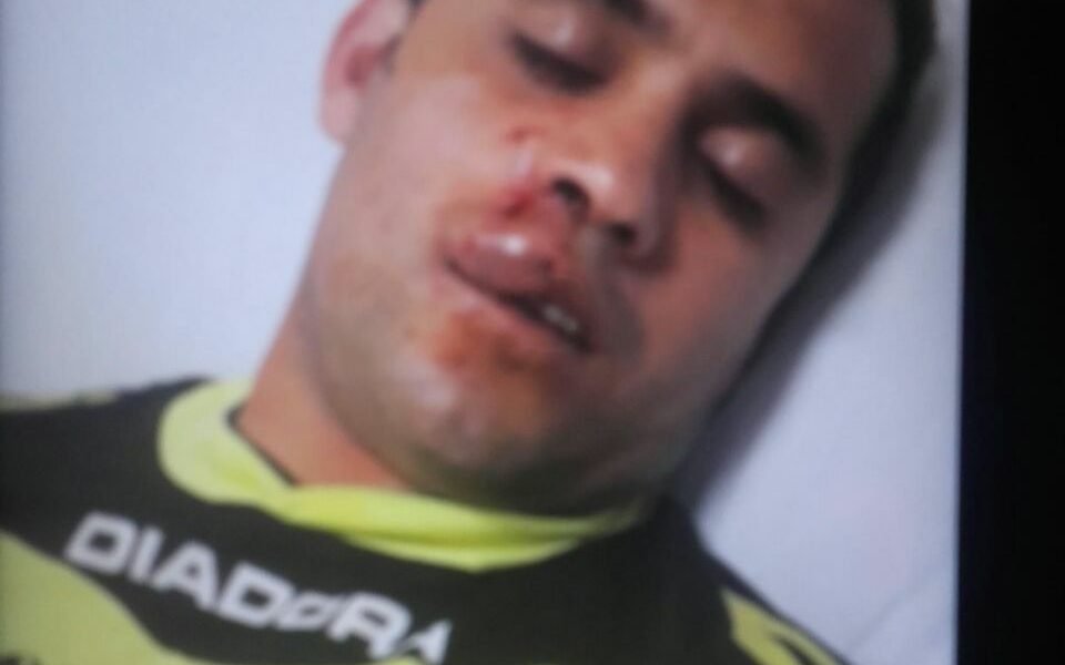 Agresión a un árbitro en la Liga Cañadense