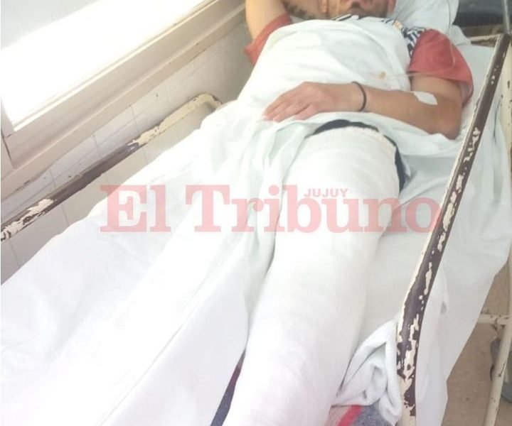 Grave lesión en Zapla: Sueldo se fracturó la tibia