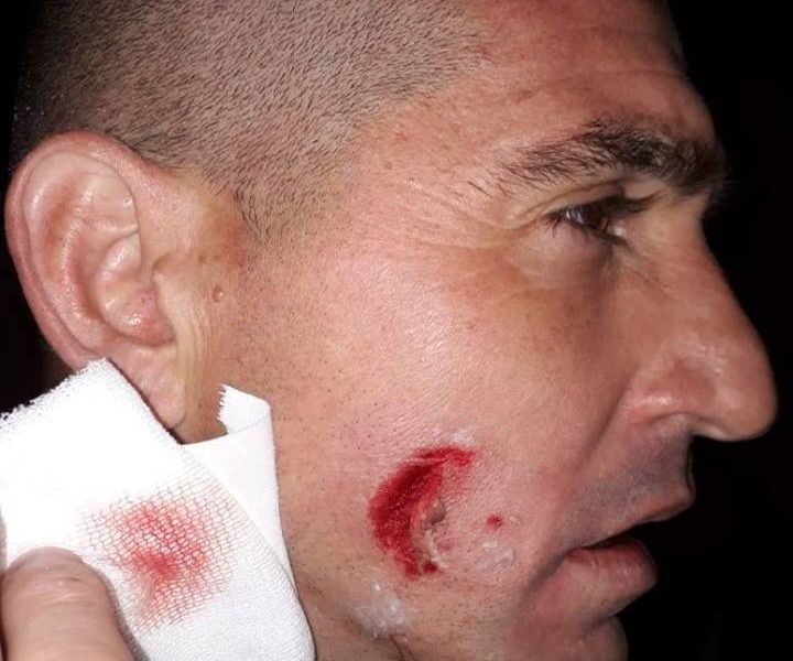 Heridos tras los incidentes entre jugadores de Roca y la policía