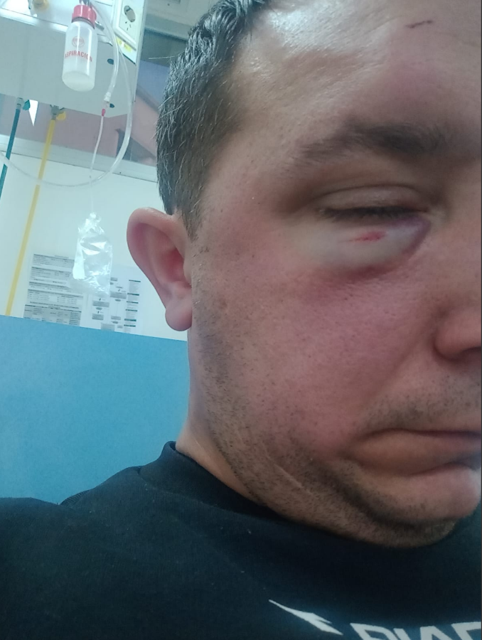 Violencia en la Liga Mercedina: un árbitro terminó hospitalizado tras ser golpeado por un DT